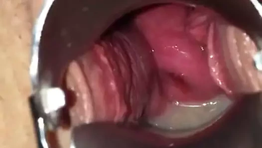 Spekulum nach ihrer Besamung