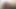 Lezbiyen üvey anne 5 sahne 2 orta yaşlı seksi kadın amcığını seviyor