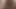 Trash Zonzon