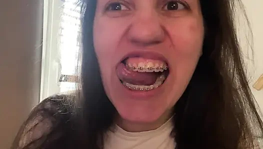 Dilinizle diş teli yalamak