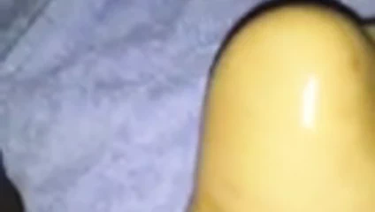 alay p-lickity'nin tabanları