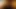 masturbation prostatique