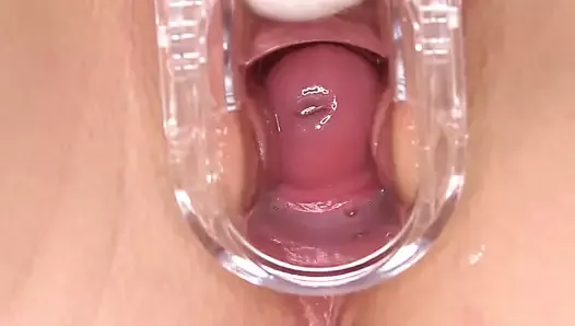 Cervix orgasm