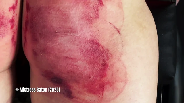 Deri esaret ve taytla belden bağlamalı