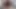 tüm yapay penis esneme derleme sept 2022