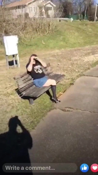 Sıcak kalça ampute