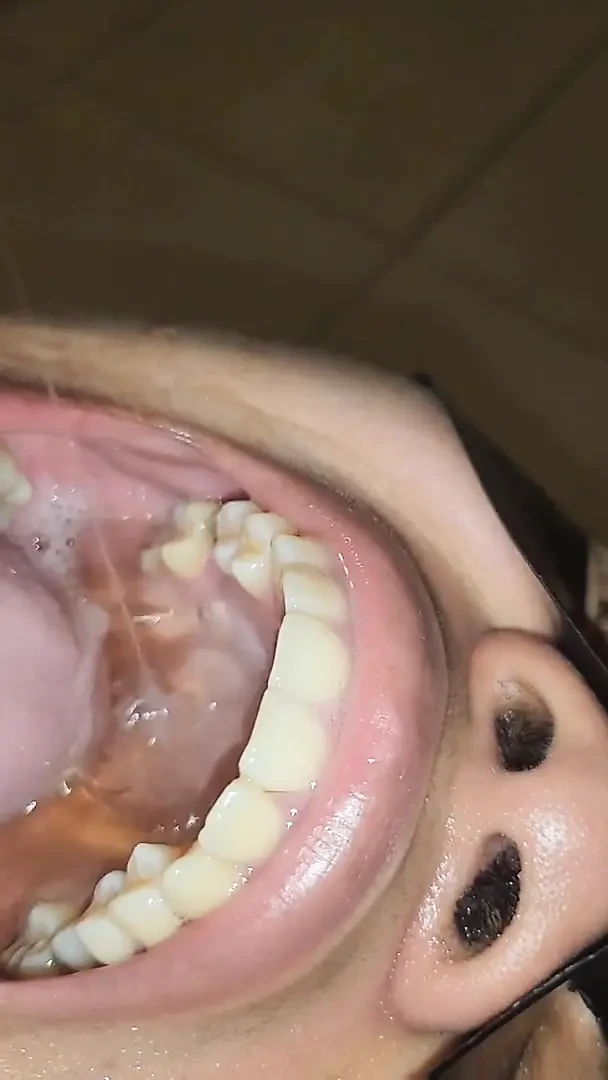 Kölem örümcek adamı taklit etti ve süt gırtlağına kadar baş aşağı durdu