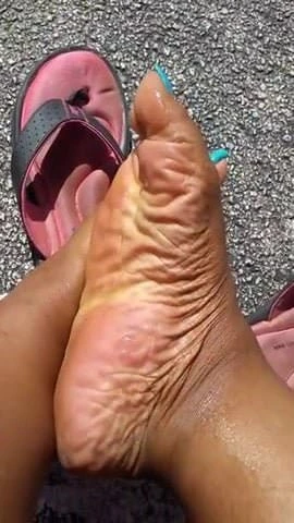 abanoz ayak parmak arası terlik