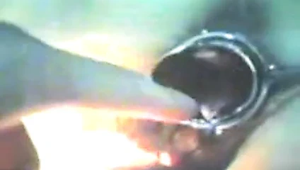 (49)zhangjiajing hemşireler hemşireler(tayvan)