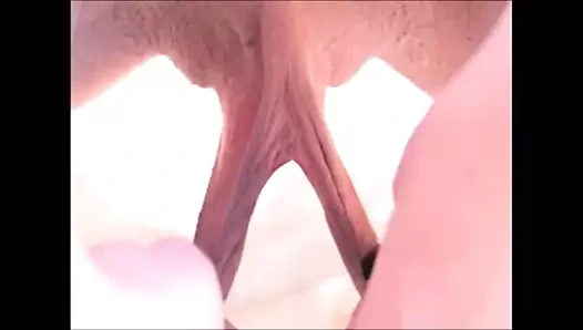 Labia