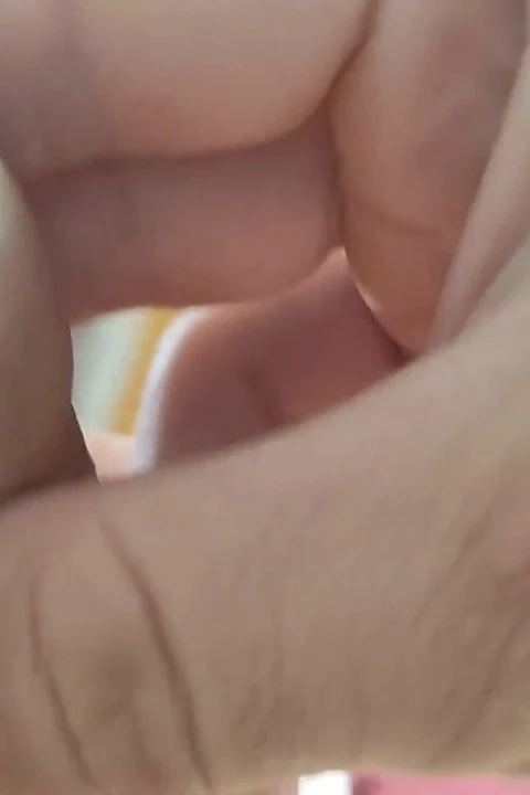 Finozun Içinde Glans Taçlanmış Gibi Görünür.