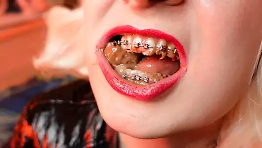 Asmr mukbang yemek fetişi diş telleri ile video yeme fetişi