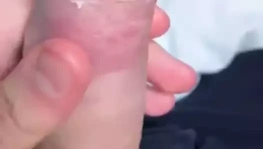 Damarlı smegma çük