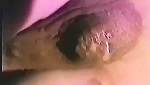 Süt için meme uçları