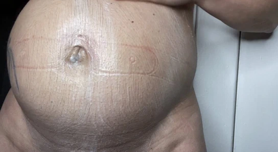 Everydeygrey, büyük kıllı göbeğe losyon sürer.