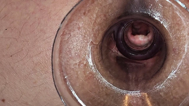 Göt deliğimin derinliklerinde bakış açısı görünümü