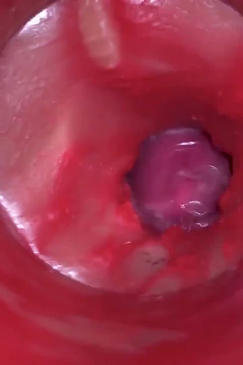 Amcığın içindeki kamera - amına güçlü boşalma! En iyi iç asmr
