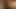 anal teaser