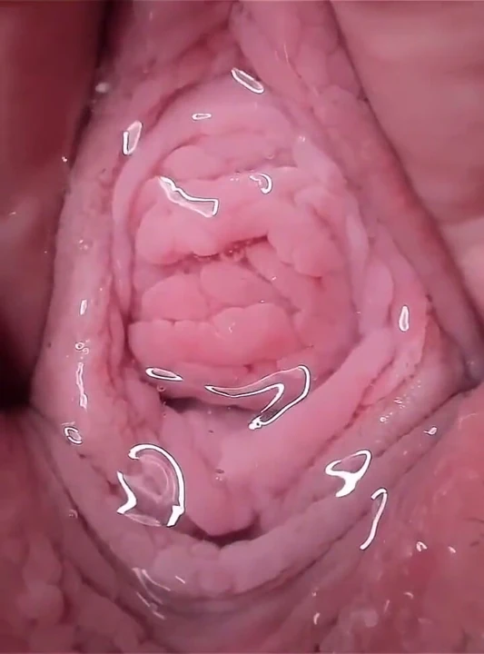 See Inside Me