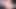 Ayakları şeker teaser ile ovuyor
