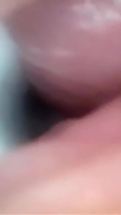 Serviks geniş esneyen amcık endoskopunda sperm! | Klip 1