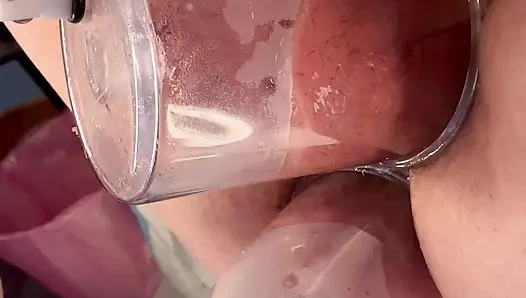 Çift Vakum Pompalama