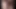 Seksi Alman kızların intese mastürbasyonu - bölüm 8