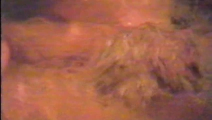 EX B badet