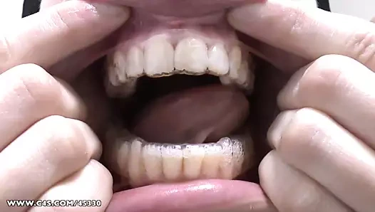 Plastik tutucum için serbest bırakın