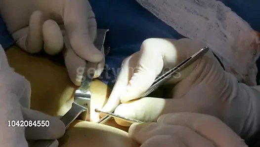 Aj lee üçüncü bir meme kazanıyor!