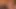 Austin yapay penis ile atıyor