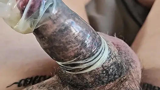 Kullanılmış prezervatif