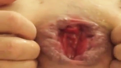 Anal oyunlar prolapsus germe eşek esneme eşek sokma