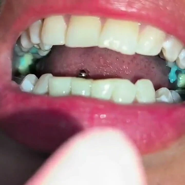 Snake Gum