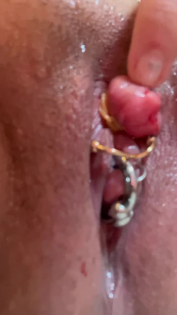 Увеличенный связыв клитор