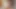 Vrlatina - vr'de gergin latin kolej kontrolü