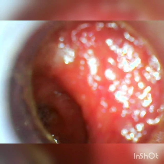 USB Endoscope ass withdraw 80cm deep
