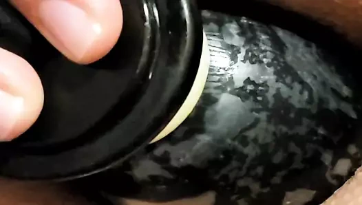 Gerçek anal takıntı