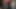 Mstess derlemesi