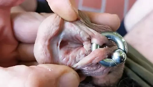 Alt kesi ve piercing