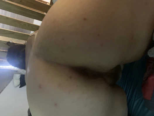 Ona maruz kaldı, götümü parçalıyor!