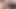 Bu sportif kız onun yüzünden asla giyinemiyor