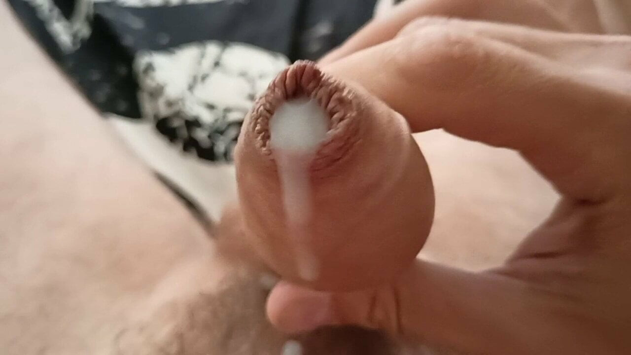 Sünne derisi, sünnet, sperm, eşcinsel