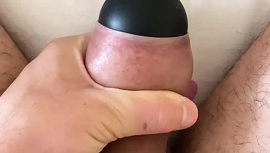 Aşırı sünnet derisi pompalama