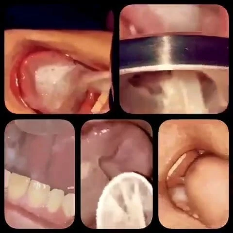 Zeff77 Gang vs CumWhore YopLover