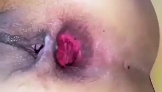 LOOSE AMATEUR ASSHOLE CALABASH ANAL GAPE