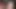 Aurora kar teaser 6