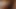Mercan aort teaser 3