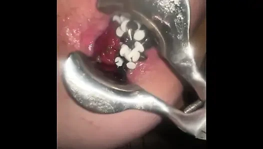 Thumtacks acıtıyor