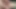 Xh_Cellphone videosu - idrar kesesini 02.04.24'ten itibaren fortimel ile doldurun